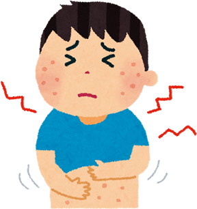 アレルギー(アトピー)性皮膚炎